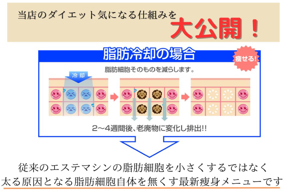 高知で初の脂肪冷却では従来の脂肪細胞を小さくするのではなく、脂肪細胞そのものをなくしてしまうのです